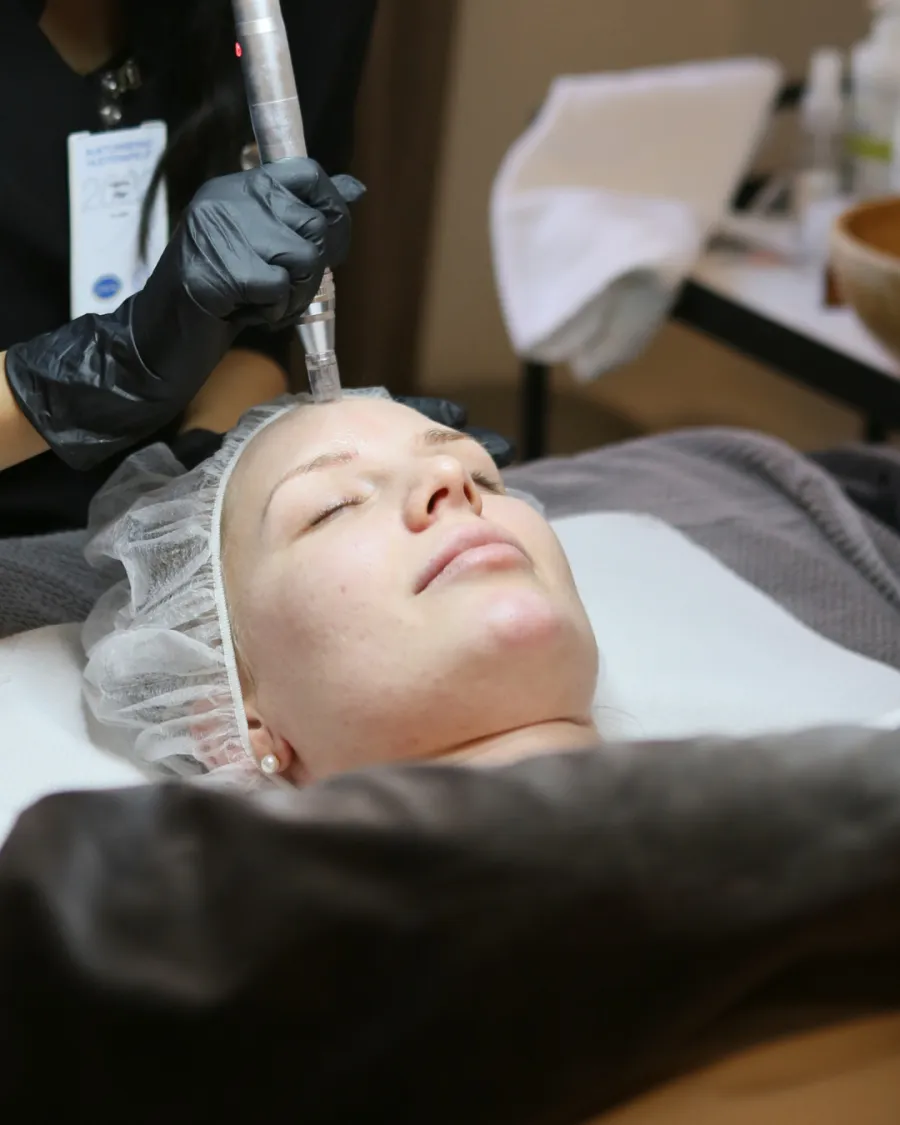 Microneedling behandling